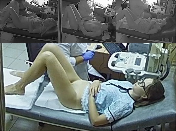 Ultrasound 11