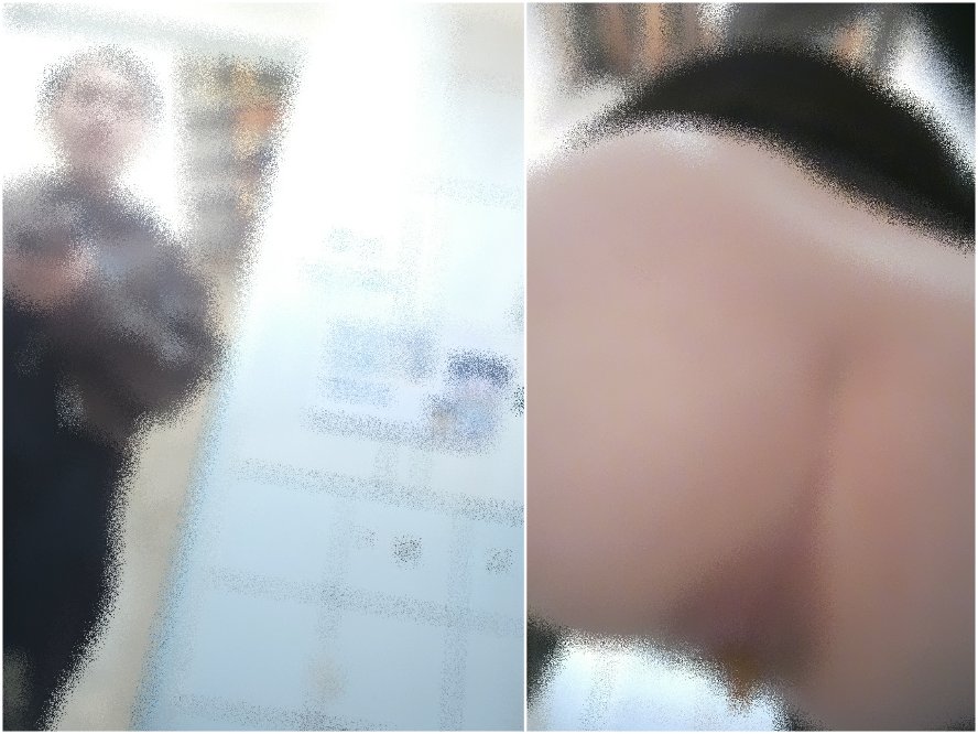 【トイレ盗撮】黒透けパンのコントラスト、肛門が破裂して下痢が噴出