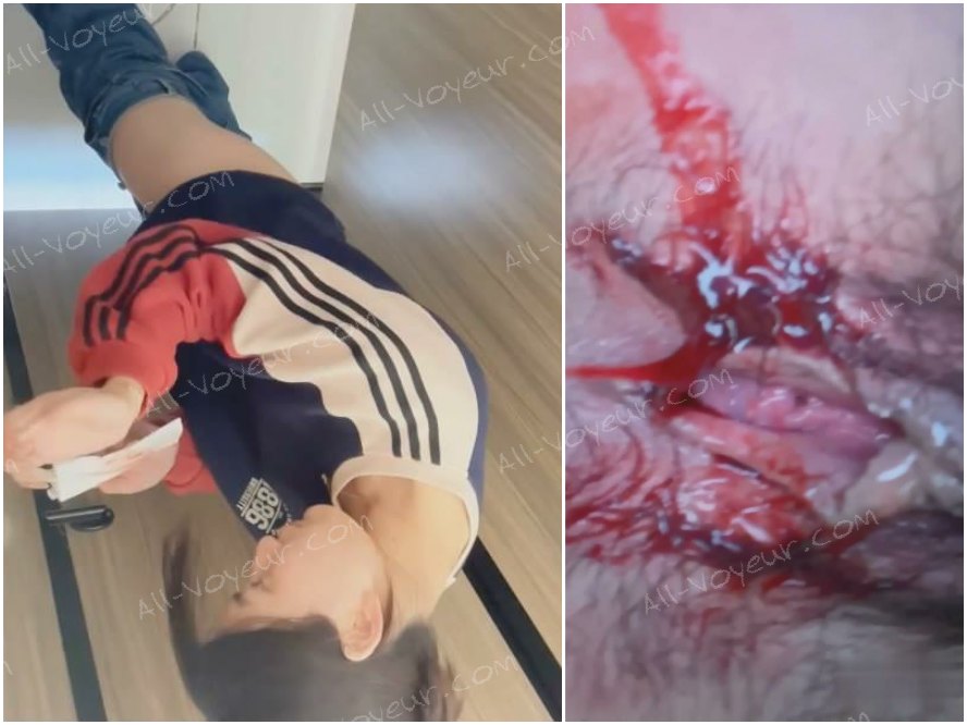 生理の血にまみれた可憐な女子大生の膣を捉えた高画質の隠し撮り。膣の内部構造を詳しく観察すると、汚れた手の匂いまで嗅いでいる様子がわかる。